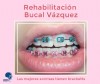 rehabilitacion bucal  - EXPO 15